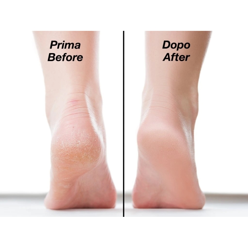 Beper - Exfoliačný kameň na peeling, mentolový