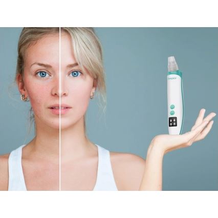 Beper - Nabíjateľný čistič pórov USB/5V 400 mAh